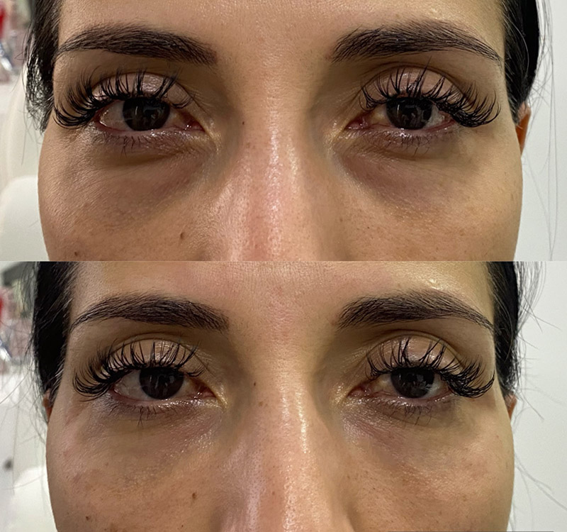 Brighter, Rested Eyes