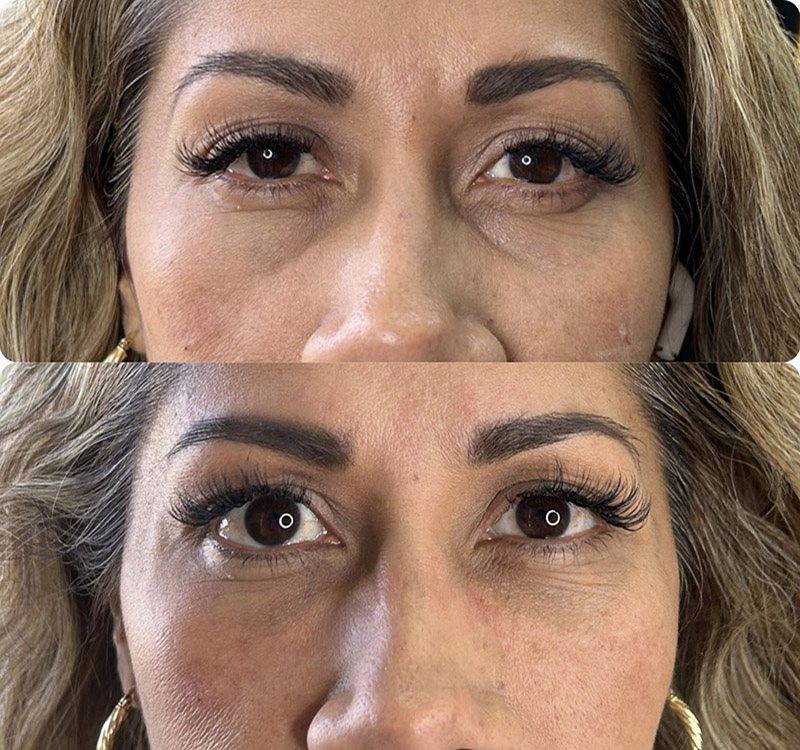 Brighter, Rested Eyes
